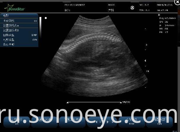 C10 Color Doppler Ultrasound System For Hostipal